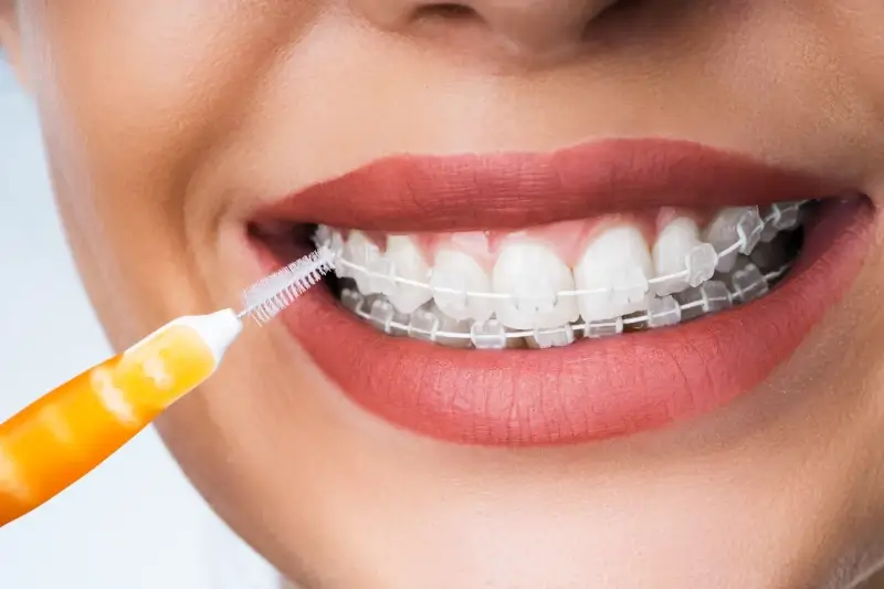 Stomatologia dziecięca Szczecin