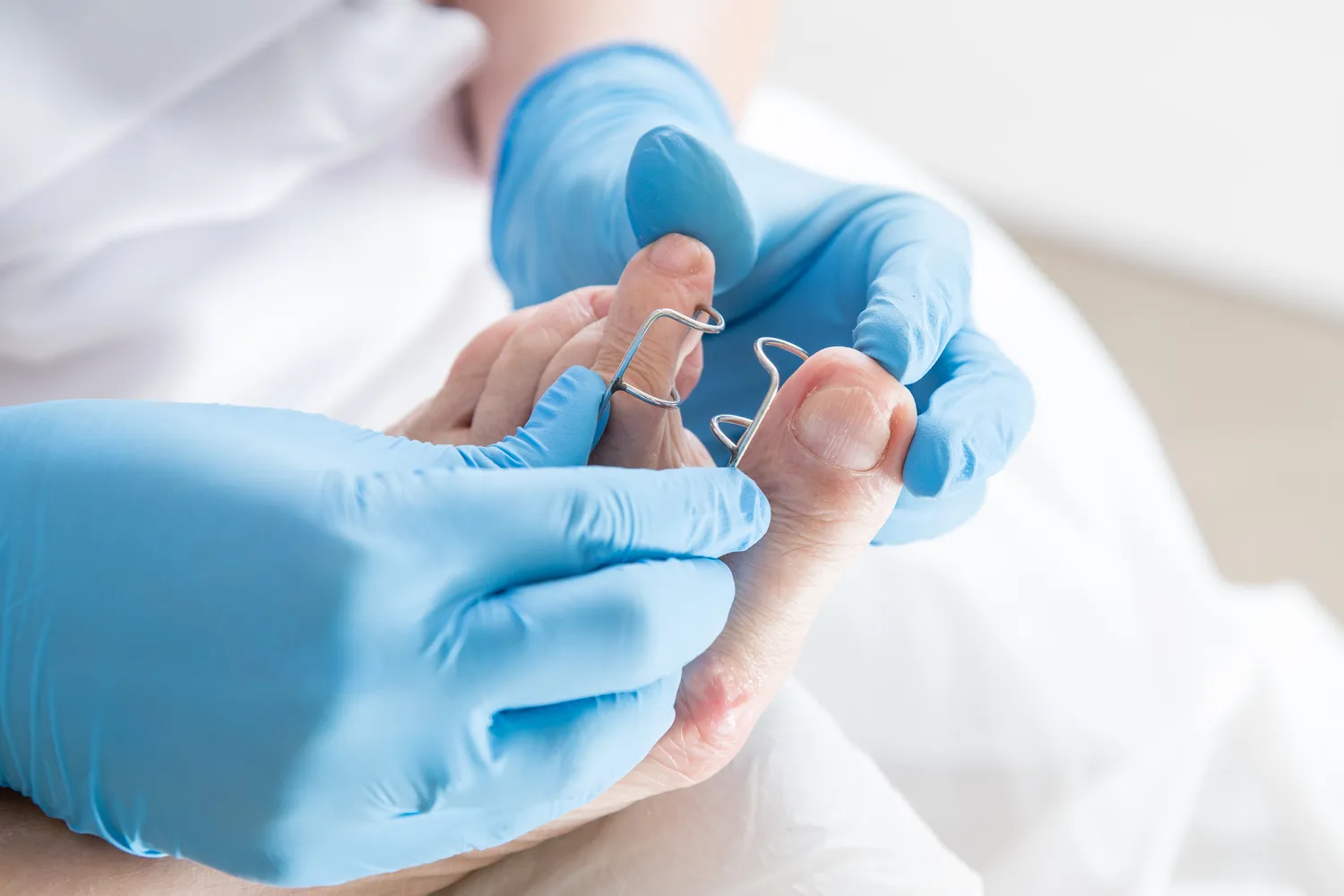 Podologia - czym jest i kiedy warto udać się do podologa?