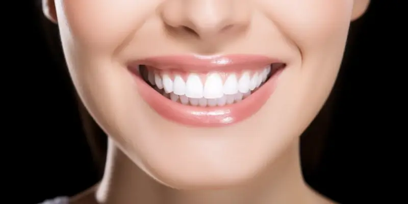 Licówki porcelanowe Szczecin