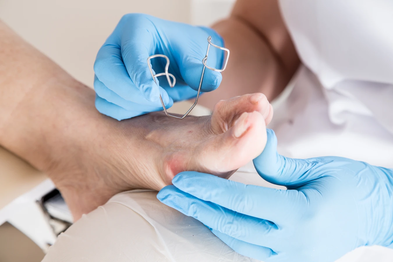 Na problemy ze stopami - podologia